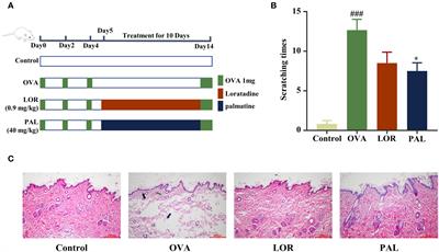 Palmatine treats urticaria by reducing inflammation and increasing autophagy